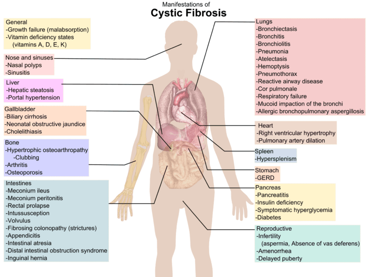 Cystic Fibrosis Manifestations